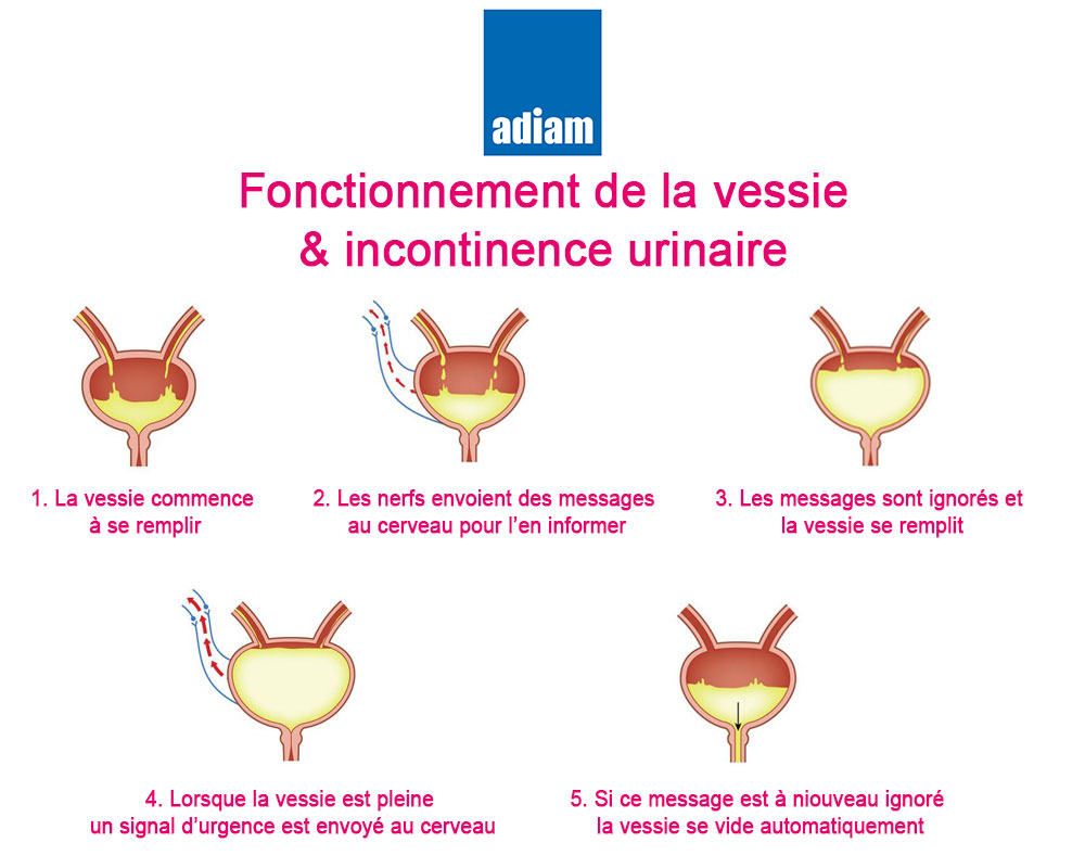 symptôme incontinence urinaire