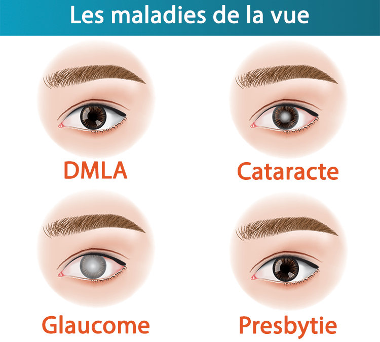 Maladie Œil senior Paris