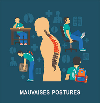 Mauvaise posture ostéoporose
