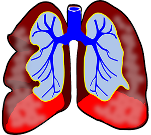 poumon asthme