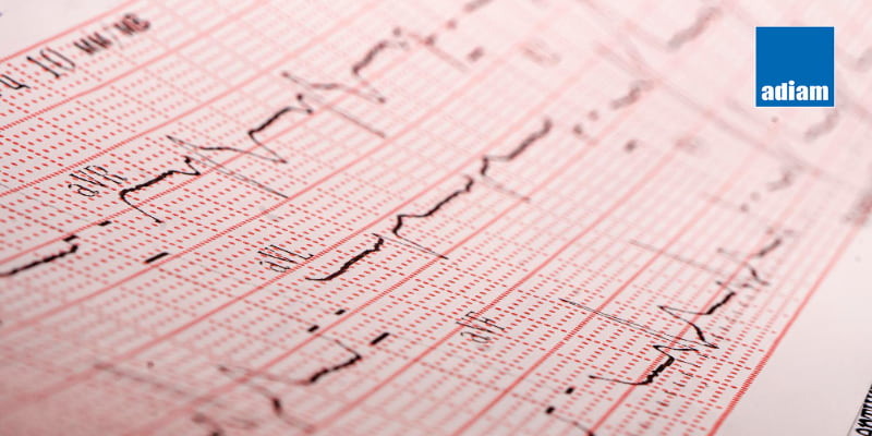 diagnostic maladie charcot