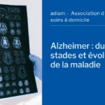 Alzheimer duree des stades maladie